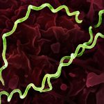Syphilis